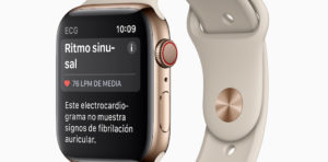 Apple watch ecg result es es screen