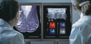 [Image] LG Diagnostic Monitor (21HQ613D)