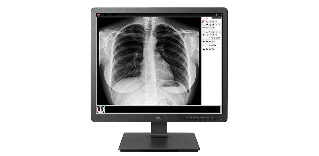 Η LG παρουσιάζει τη νέα σειρά ιατρικών συσκευών απεικόνισης
